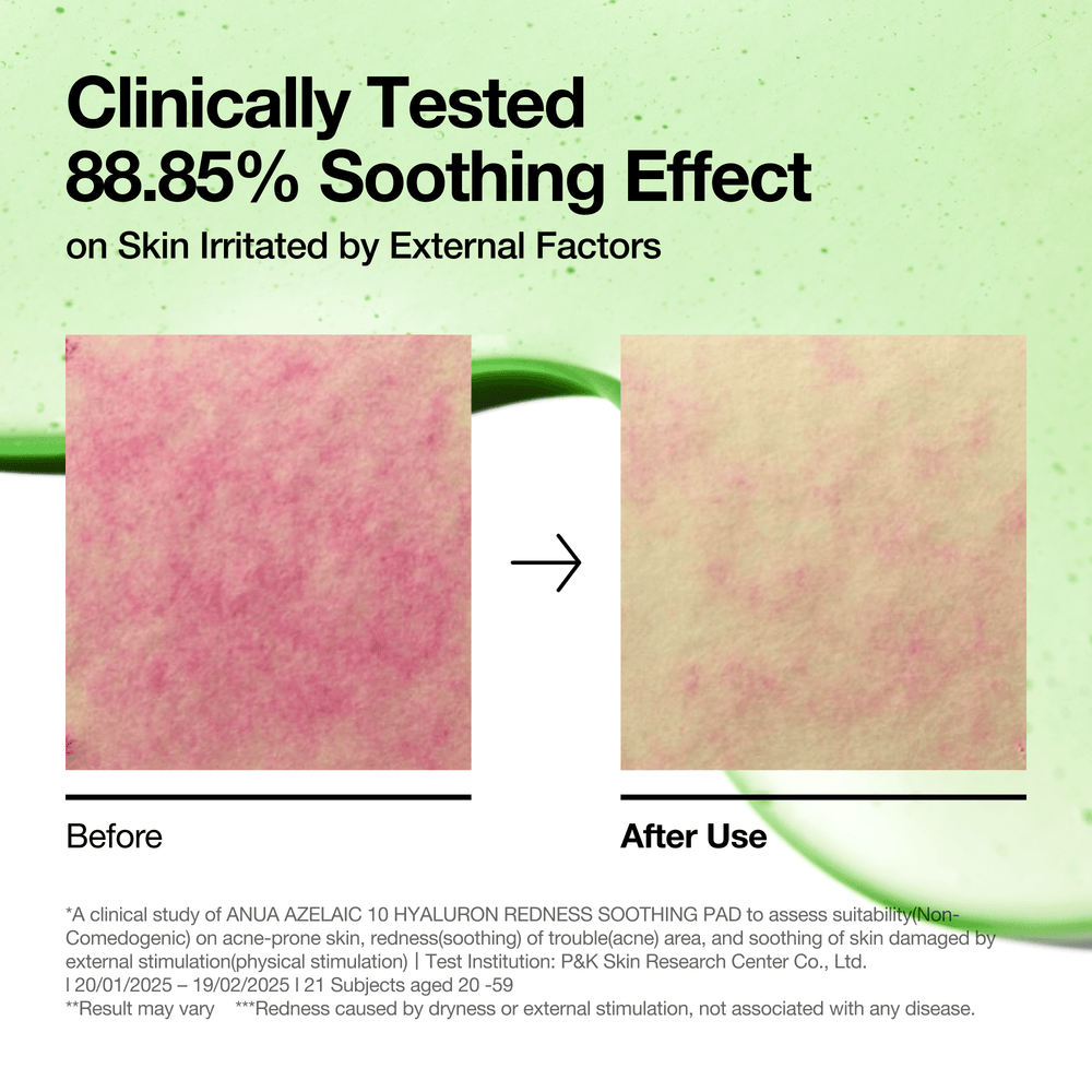 [Anua] Azelaic 10 Hyaluron Redness Soothing Pad 230ml 90 Stk.